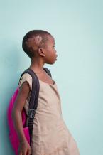 Fifa: This image to depicts the burns she suffered before coming to the orphanage. There are scars on both sides of her head and on the back of both her arms.